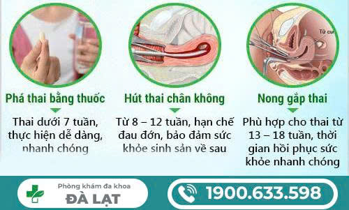 Hình ảnh minh họa